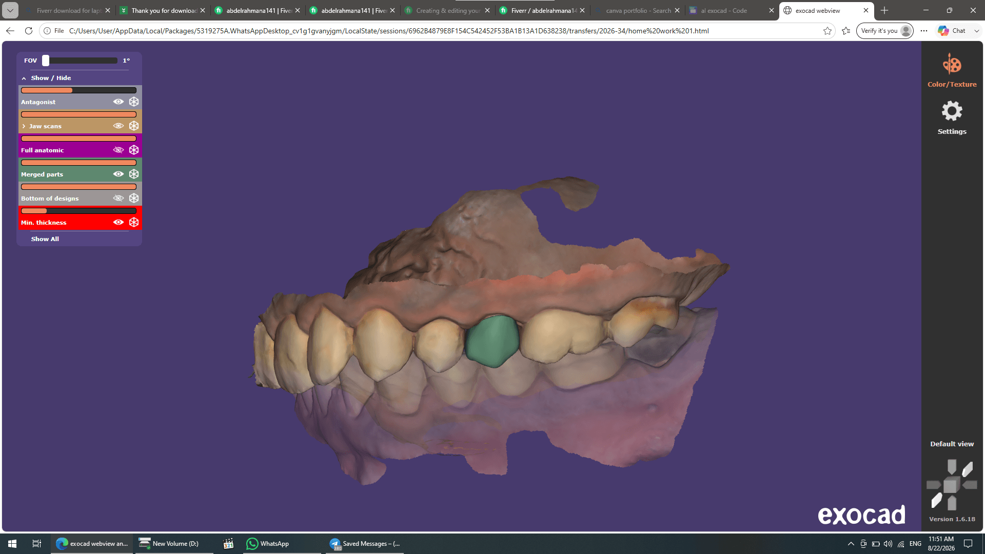 Professional Exocad Dental CAD Design β Crowns, Bridges & More