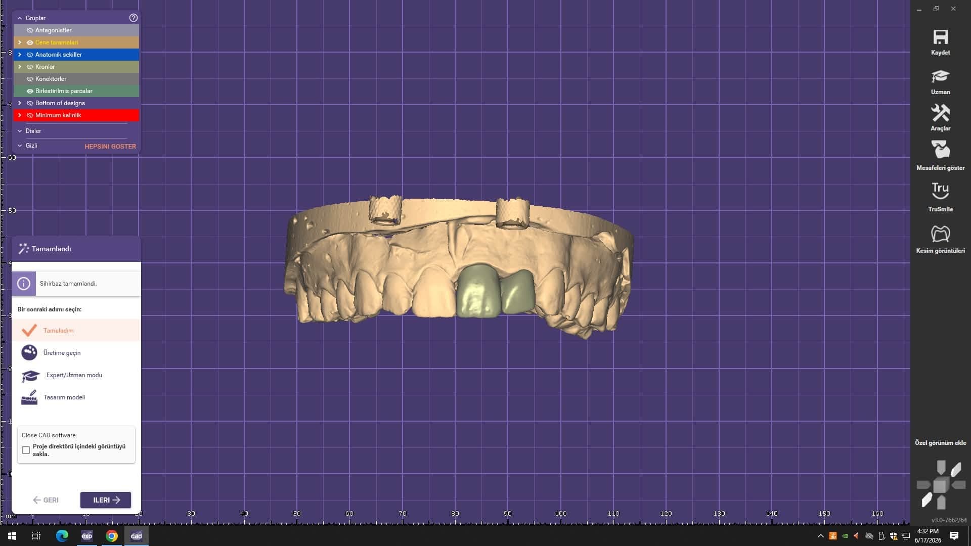 Full Zirconia Crown