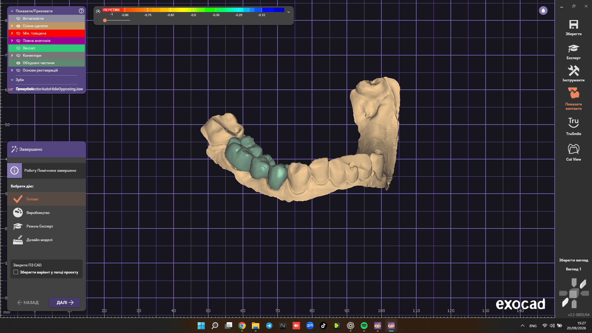 3-Unit Zirconia Bridge Design (44–46) with Pontic 45