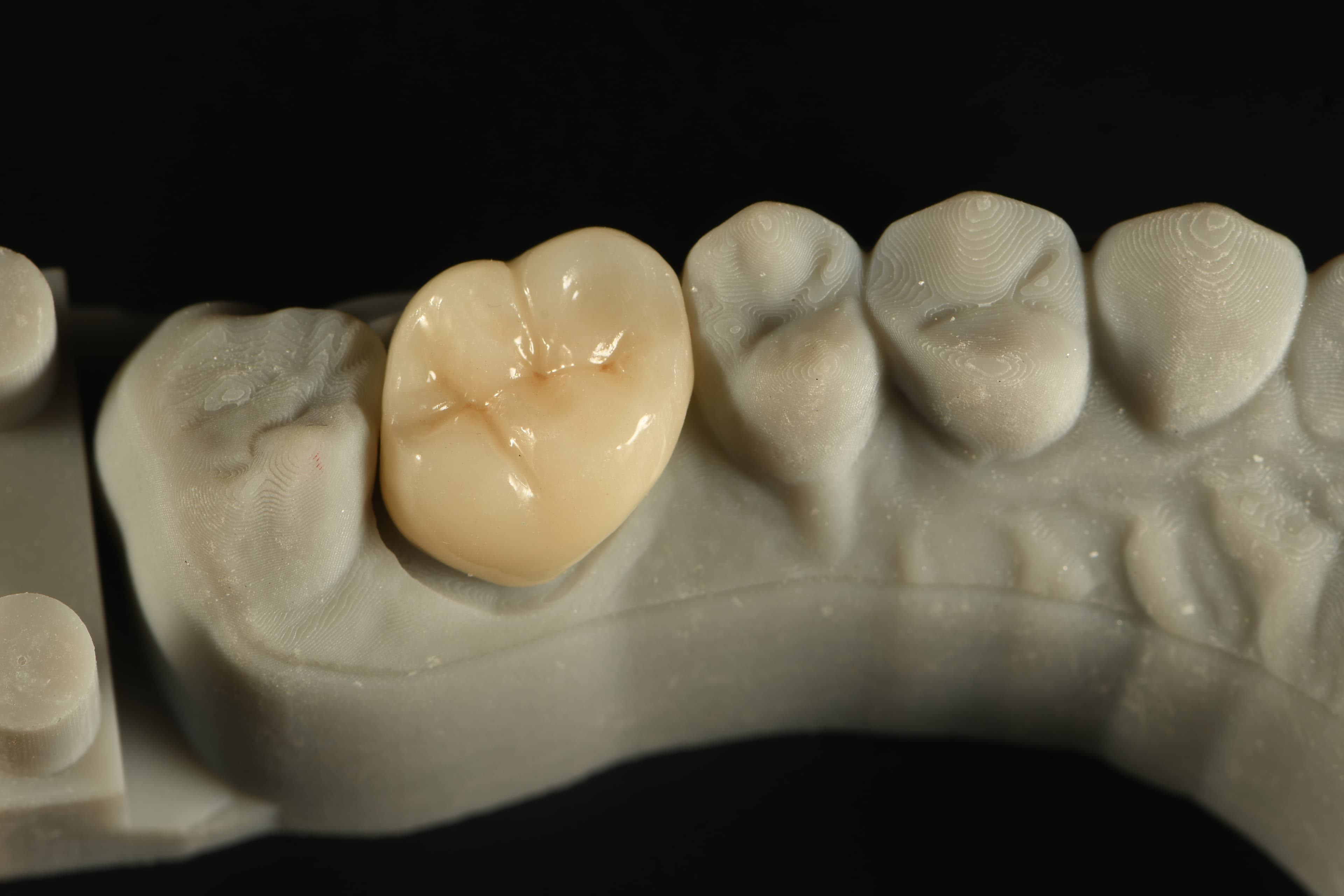 Aidite 3D Pro Multilayer Full Zirconia (Posterior)