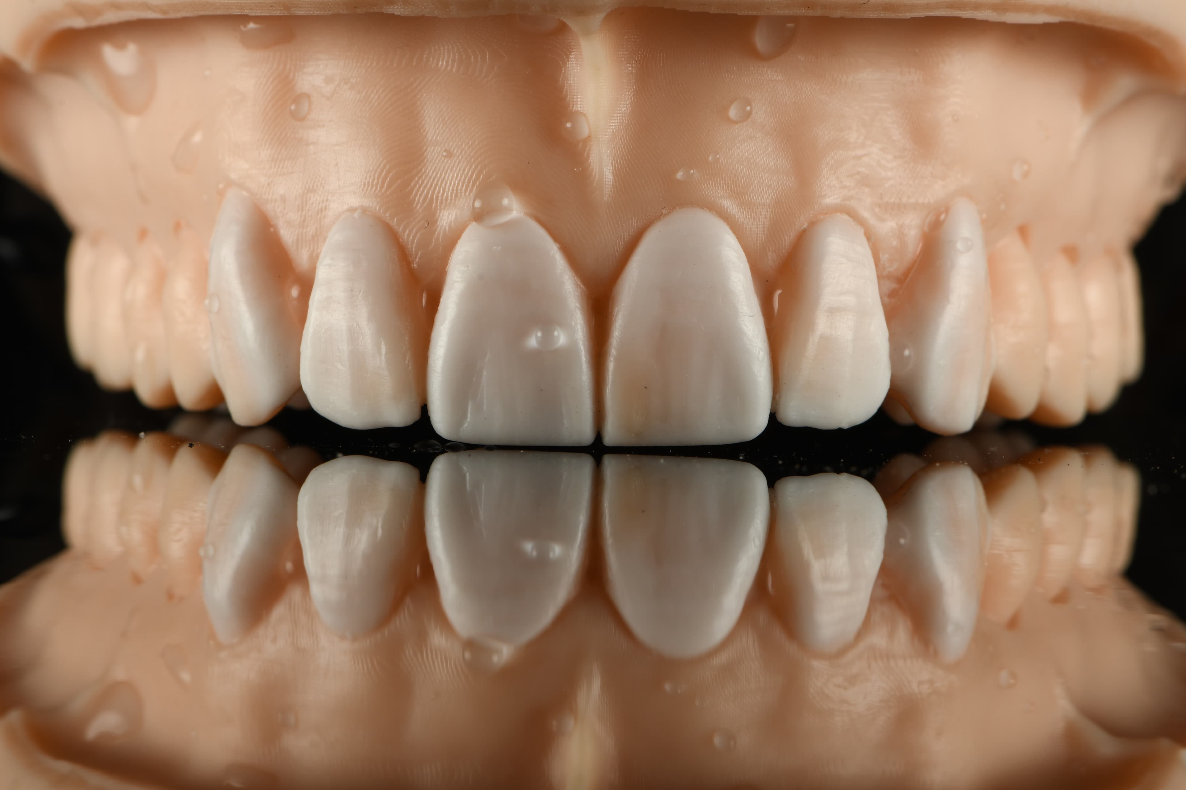 Diagnostic Wax-up