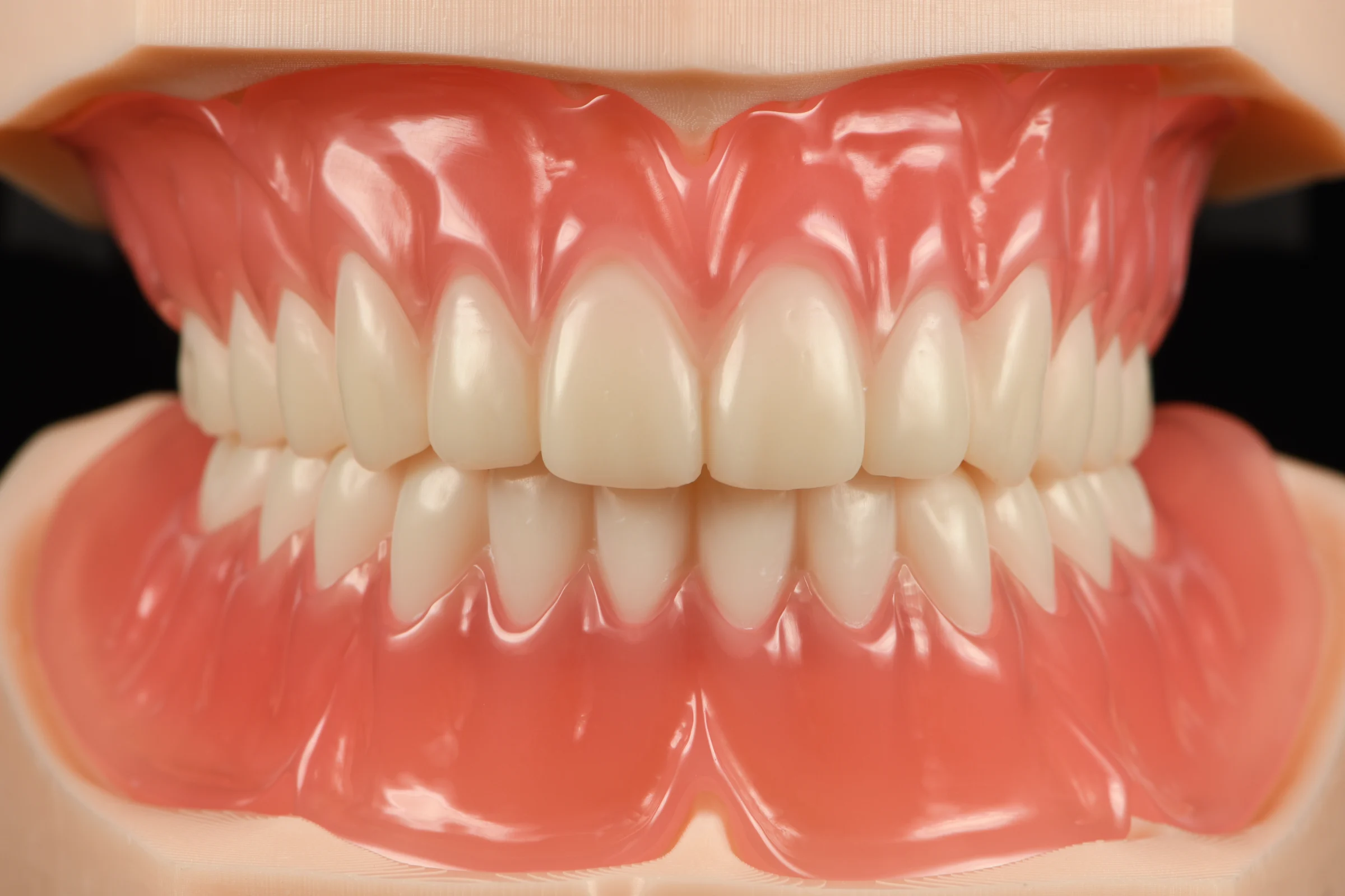 Full denture (per arch)